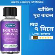 Wart Remover 30 ML